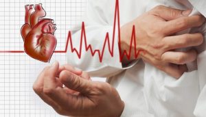 Bệnh lý về tim mạch